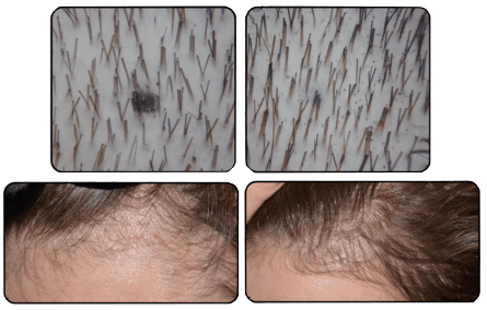 Diagnóstico Capilar