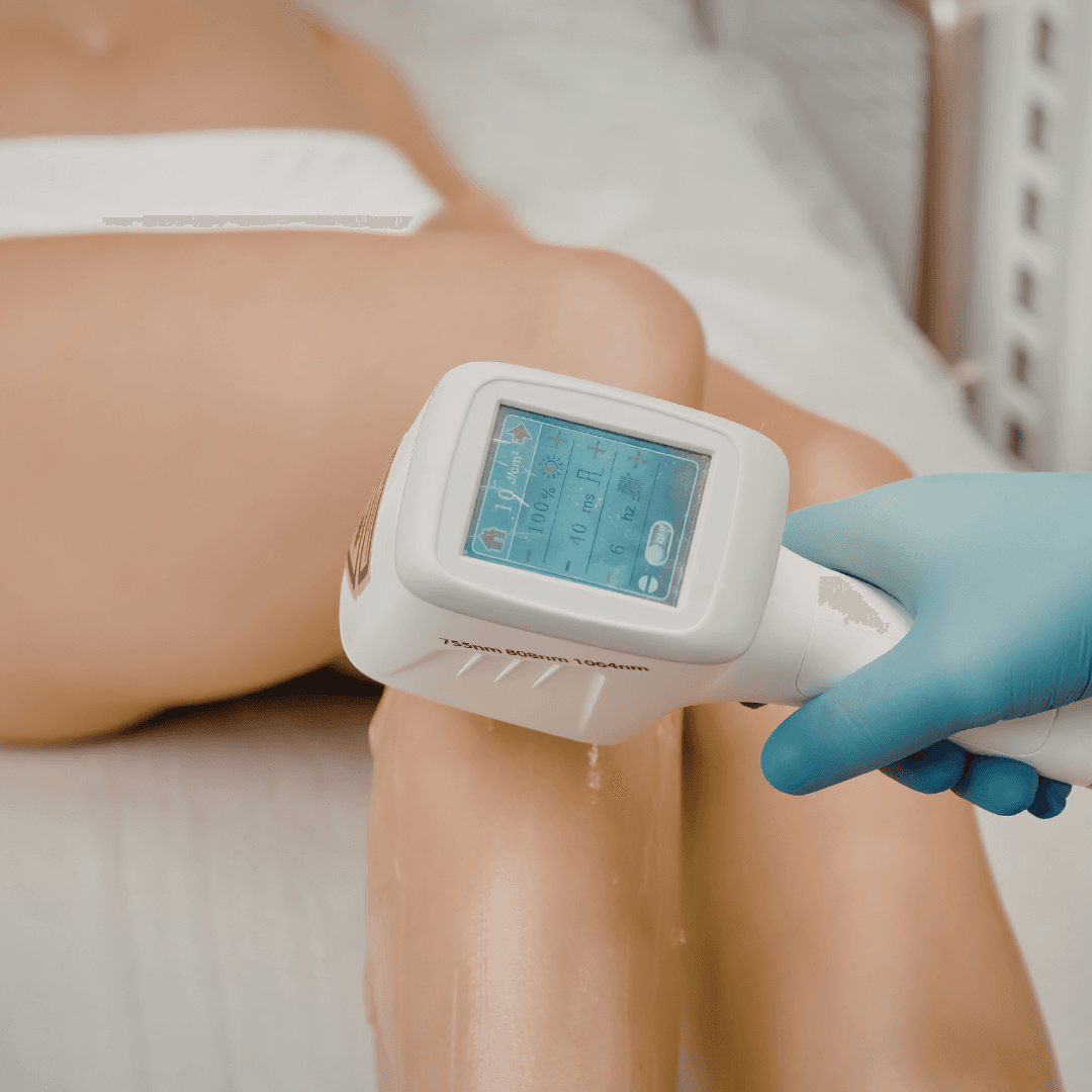 Epilação Profissional